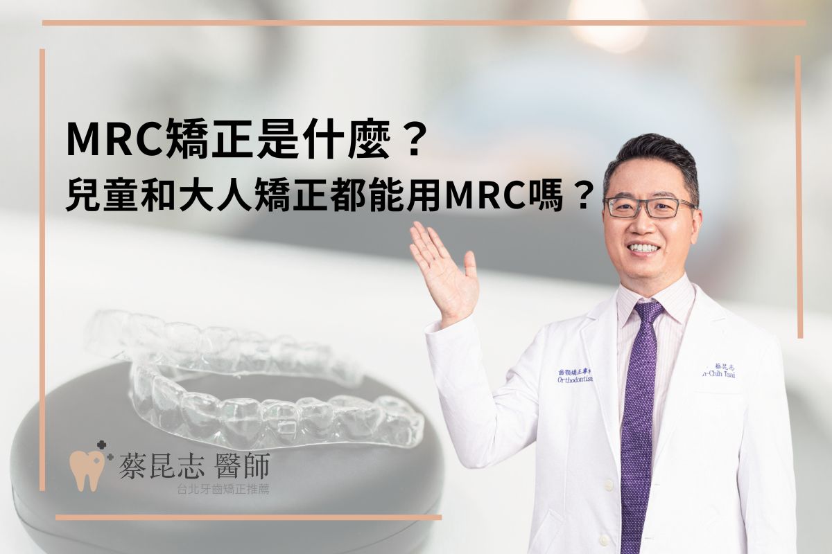 Read more about the article MRC矯正是什麼？兒童和大人矯正都能用MRC嗎？