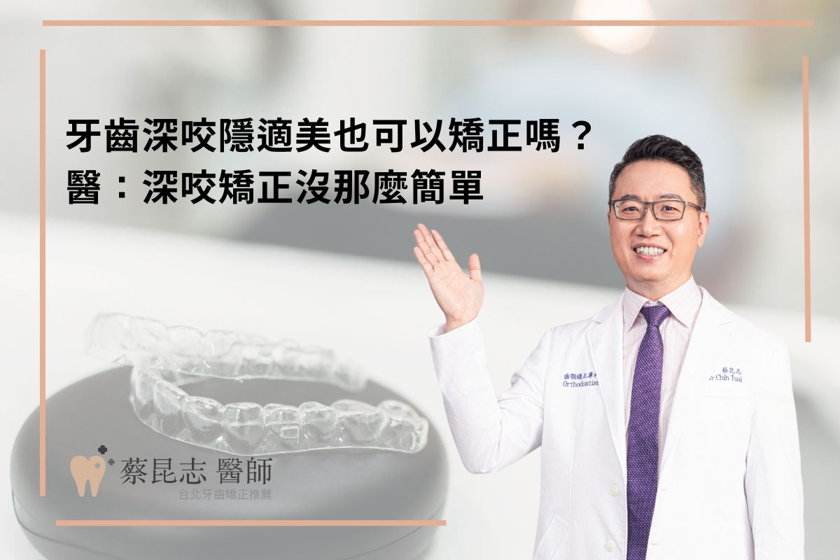 Read more about the article 牙齒深咬隱適美也可以矯正嗎？醫：深咬矯正沒那麼簡單