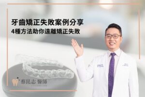 牙齒矯正失敗案例分享，4種方法助你遠離矯正失敗